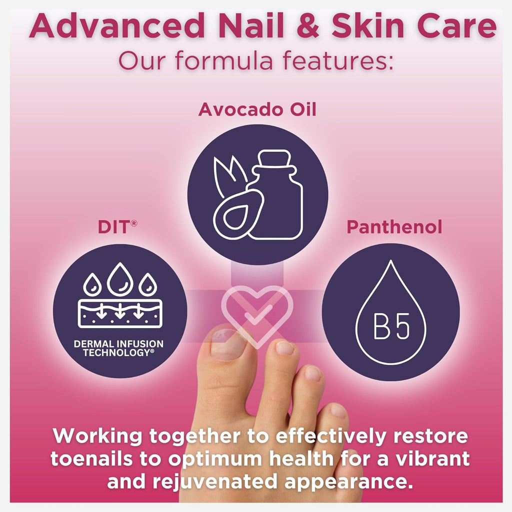1.7 Fl Oz Anti-Fungal Toe Tincture Spray M35859