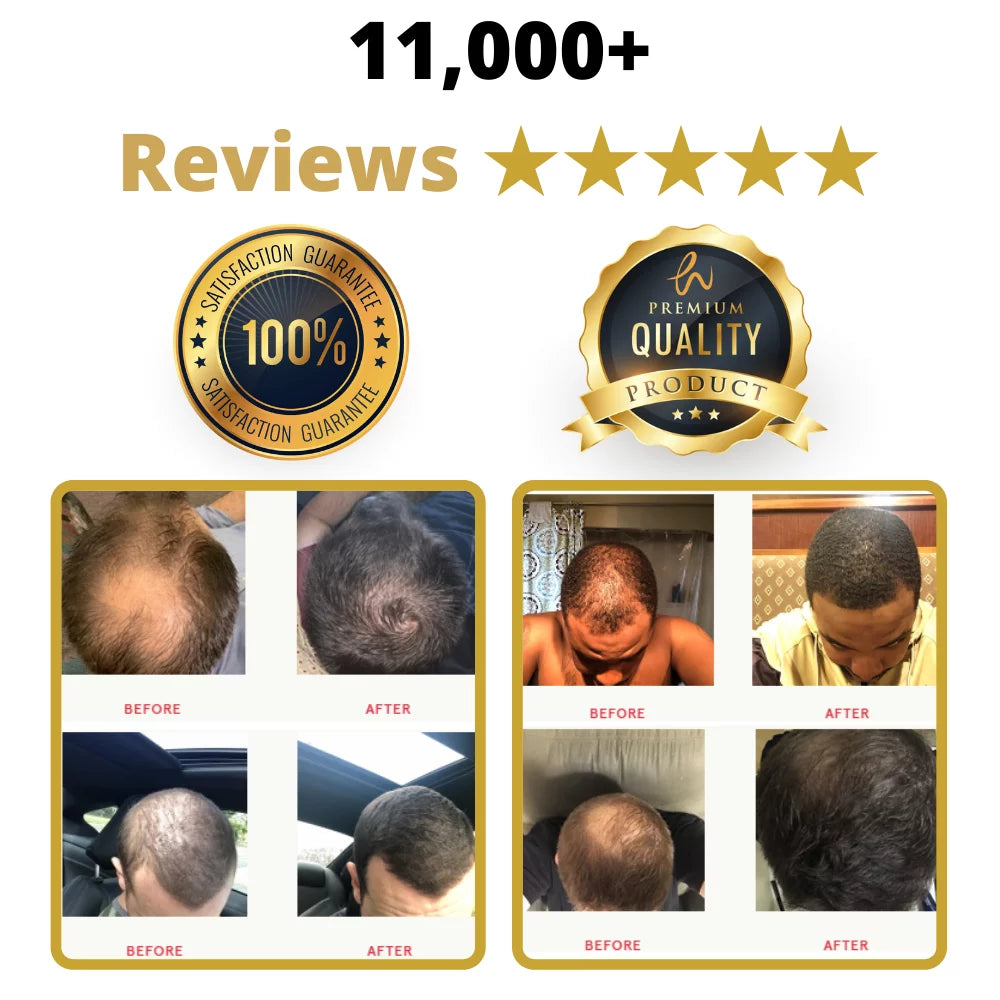 Caffeine Shampoo With Minoxidil Kit C6038