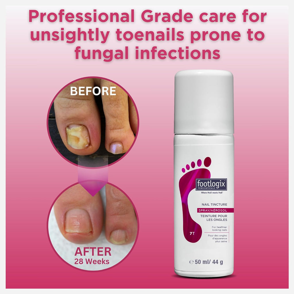 1.7 Fl Oz Anti-Fungal Toe Tincture Spray M35859