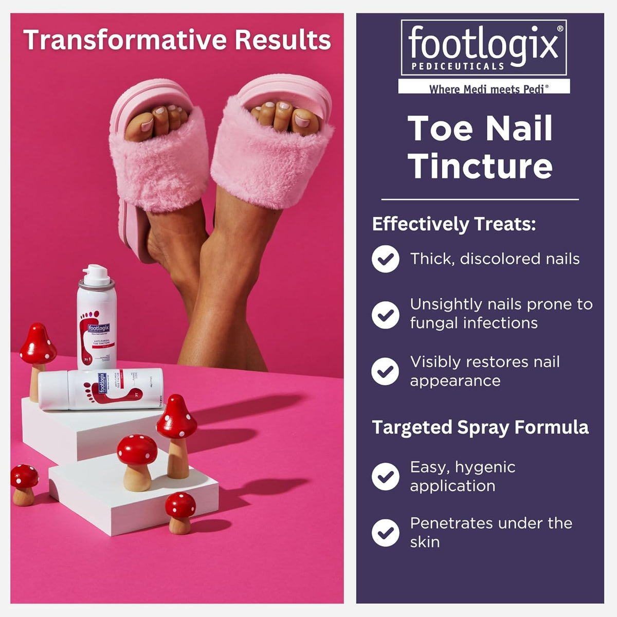 1.7 Fl Oz Anti-Fungal Toe Tincture Spray M35859